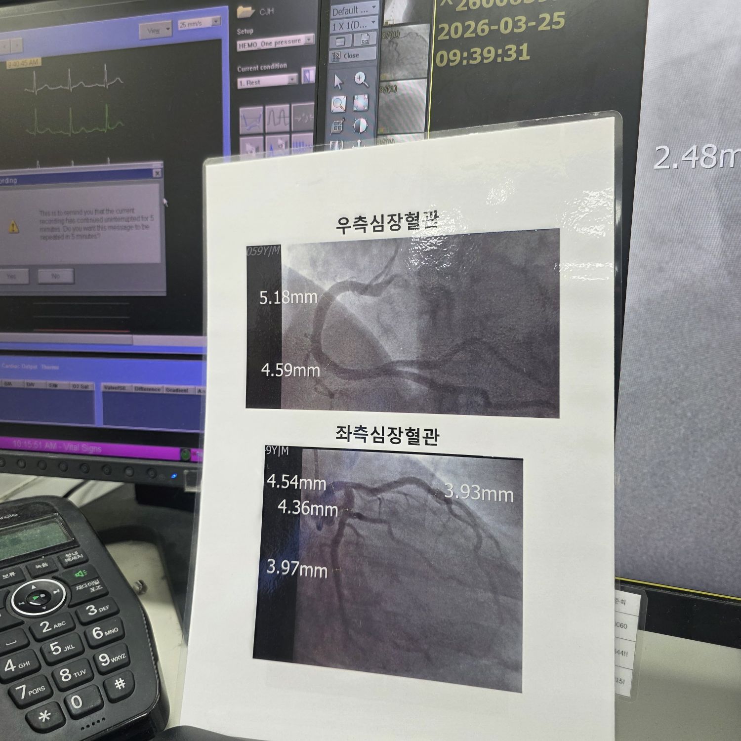 イ・チャンウォンのビハインドカット