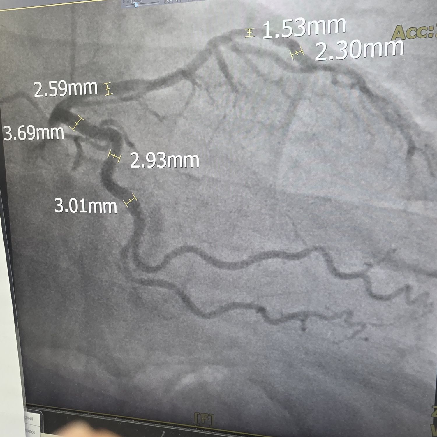 粉丝拍下的李灿元瞬间