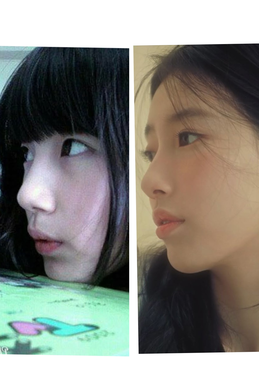 ペ・スジのビハインドカット